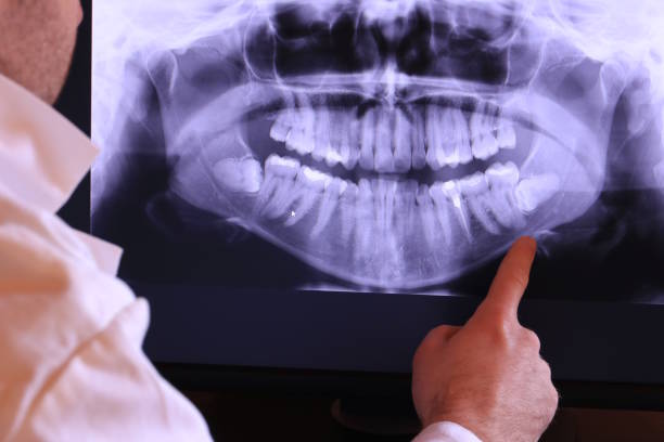 Best Emergency Tooth Extraction  in Stratford, OK