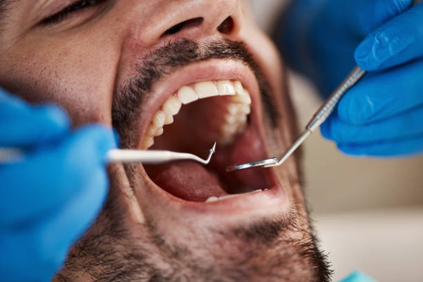 Best Emergency Dental Filling Replacement  in Stratford, OK