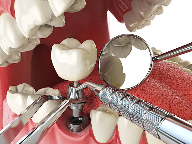 Emergency Gum Pain Relief in OK