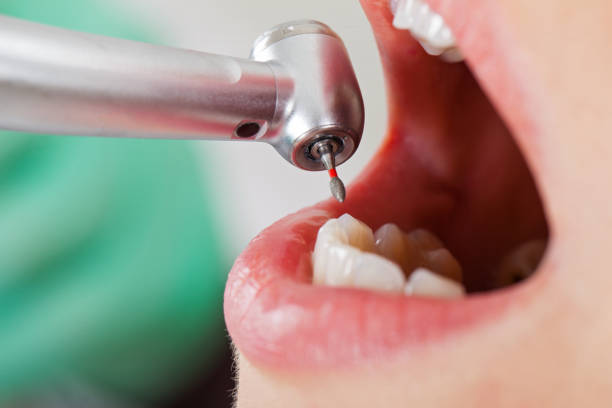 Best Broken Tooth Emergency  in Stratford, OK